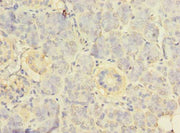 Immunohistochemistry of paraffin-embedded human pancreatic tissue using CSB-PA020402LA01HU at dilution of 1:100