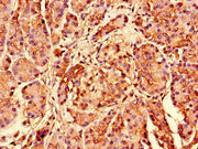 Immunohistochemistry of paraffin-embedded human pancreatic tissue using CSB-PA020407LA01HU at dilution of 1:100