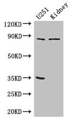 Western Blot Positive WB detected in: U251 whole cell lysate, Mouse kidney tissue All lanes: RPS6KA4 antibody at 3µg/ml Secondary Goat polyclonal to rabbit IgG at 1/50000 dilution Predicted band size: 86, 85 kDa Observed band size: 86 kDa