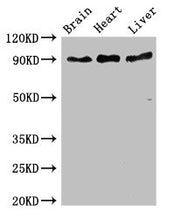 Western Blot Positive WB detected in: Mouse brain tissue, Rat heart tissue, Rat liver tissue All lanes: RPS6KA5 antibody at 3ug/ml Secondary Goat polyclonal to rabbit IgG at 1/50000 dilution Predicted band size: 90, 62, 82 kDa Observed band size:...