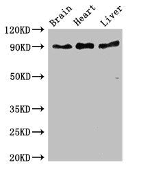 Western Blot Positive WB detected in: Mouse brain tissue, Rat heart tissue, Rat liver tissue All lanes: RPS6KA5 antibody at 3ug/ml Secondary Goat polyclonal to rabbit IgG at 1/50000 dilution Predicted band size: 90, 62, 82 kDa Observed band size:...