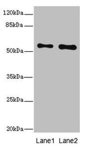 Western blot All lanes: RPS6KL1 antibody at 4.02ug/ml Lane 1: Mouse heart tissue Lane 2: Mouse kidney tissue Secondary Goat polyclonal to rabbit IgG at 1/10000 dilution Predicted band size: 61, 60, 29 kDa Observed band size: 61 kDa