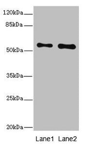Western blot All lanes: RPS6KL1 antibody at 4.02ug/ml Lane 1: Mouse heart tissue Lane 2: Mouse kidney tissue Secondary Goat polyclonal to rabbit IgG at 1/10000 dilution Predicted band size: 61, 60, 29 kDa Observed band size: 61 kDa