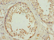 Immunohistochemistry of paraffin-embedded human testis tissue using CSB-PA020474ESR2HU at dilution of 1:100
