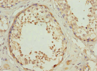 Immunohistochemistry of paraffin-embedded human testis tissue using CSB-PA020474ESR2HU at dilution of 1:100