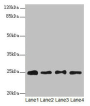 Western blot All lanes: RPS8 antibody at 6µg/ml Lane 1: HL60 whole cell lysate Lane 2: THP-1 whole cell lysate Lane 3: 293T whole cell lysate Lane 4: Mouse liver tissue Secondary Goat polyclonal to rabbit IgG at 1/10000 dilution Predicted band siz...