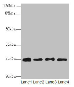 Western blot All lanes: RPS8 antibody at 6µg/ml Lane 1: HL60 whole cell lysate Lane 2: THP-1 whole cell lysate Lane 3: 293T whole cell lysate Lane 4: Mouse liver tissue Secondary Goat polyclonal to rabbit IgG at 1/10000 dilution Predicted band siz...