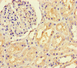 Immunohistochemistry of paraffin-embedded human kidney tissue using CSB-PA02049A0Rb at dilution of 1:100
