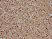 IHC image of CSB-PA020513PA01HU diluted at 1:100 and staining in paraffin-embedded human adrenal gland tissue performed on a Leica BondTM system. After dewaxing and hydration, antigen retrieval was mediated by high pressure in a citrate buffer (pH...