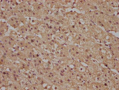 IHC image of CSB-PA020513PA01HU diluted at 1:100 and staining in paraffin-embedded human adrenal gland tissue performed on a Leica BondTM system. After dewaxing and hydration, antigen retrieval was mediated by high pressure in a citrate buffer (pH...