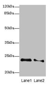 Western blot All lanes: RRAS2 antibody at 2.66µg/ml Lane 1: NIH/3T3 whole cell lysate Lane 2: A431 whole cell lysate Secondary Goat polyclonal to rabbit IgG at 1/10000 dilution Predicted band size: 24, 16, 20, 25 kDa Observed band size: 24 kDa