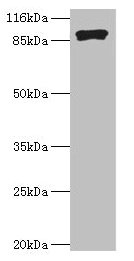 Western blot All lanes: RRM1 antibody at 2µg/ml + Hela whole cell lysate Secondary Goat polyclonal to rabbit IgG at 1/10000 dilution Predicted band size: 91 kDa Observed band size: 91 kDa