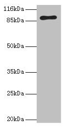 Western blot All lanes: RRM1 antibody at 2µg/ml + Hela whole cell lysate Secondary Goat polyclonal to rabbit IgG at 1/10000 dilution Predicted band size: 91 kDa Observed band size: 91 kDa