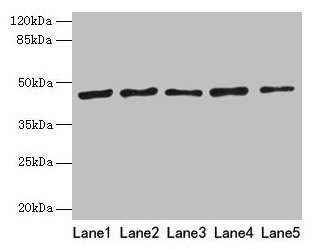 Western blot All lanes: RRM2 antibody at 8µg/ml Lane 1: HepG2 whole cell lysate Lane 2: Jurkat whole cell lysate Lane 3: Hela whole cell lysate Lane 4: K562 whole cell lysate Lane 5: 293T whole cell lysate Secondary Goat polyclonal to rabbit IgG a...