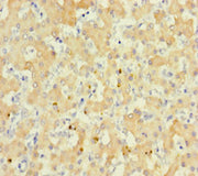 Immunohistochemistry of paraffin-embedded human liver tissue using CSB-PA020534LA01HU at dilution of 1:100