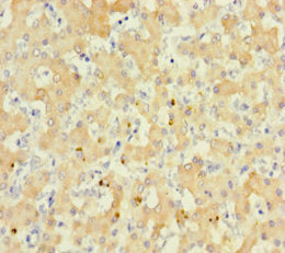 Immunohistochemistry of paraffin-embedded human liver tissue using CSB-PA020534LA01HU at dilution of 1:100