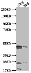 Western Blot Positive WB detected in Recombinant protein All lanes: rsad2 antibody at 1:2000 Secondary Goat polyclonal to rabbit IgG at 1/50000 dilution Predicted band size: 44.1 kDa Observed band size: 44 kDa