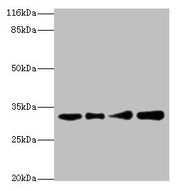 Western blot All lanes: RSU1 antibody at 2µg/ml Lane 1: Human placenta tissue Lane 2: Caco-2 whole cell lysate Lane 3: Jurkat whole cell lysate Lane 4: HepG2 whole cell lysate Secondary Goat polyclonal to rabbit IgG at 1/10000 dilution Predicted b...