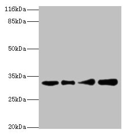 Western blot All lanes: RSU1 antibody at 2µg/ml Lane 1: Human placenta tissue Lane 2: Caco-2 whole cell lysate Lane 3: Jurkat whole cell lysate Lane 4: HepG2 whole cell lysate Secondary Goat polyclonal to rabbit IgG at 1/10000 dilution Predicted b...