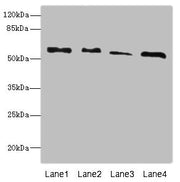 Western blot All lanes: RTKN antibody at 4.66ug/ml Lane 1: A431 whole cell lysate Lane 2: HepG2 whole cell lysate Lane 3: MCF-7 whole cell lysate Lane 4: Mouse brain tissue Secondary Goat polyclonal to rabbit IgG at 1/10000 dilution Predicted band...