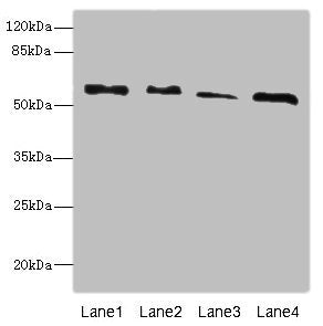 Western blot All lanes: RTKN antibody at 4.66ug/ml Lane 1: A431 whole cell lysate Lane 2: HepG2 whole cell lysate Lane 3: MCF-7 whole cell lysate Lane 4: Mouse brain tissue Secondary Goat polyclonal to rabbit IgG at 1/10000 dilution Predicted band...