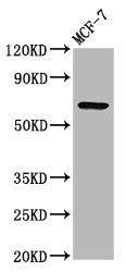 Western Blot Positive WB detected in: MCF-7 whole cell lysate All lanes: RYK antibody at 3.3ug/ml Secondary Goat polyclonal to rabbit IgG at 1/50000 dilution Predicted band size: 68 kDa Observed band size: 68 kDa