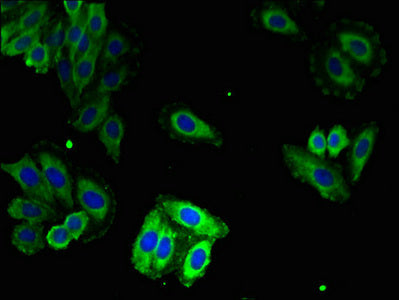 Immunofluorescent analysis of HepG2 cells using CSB-PA020619LA01HU at dilution of 1:100 and Alexa Fluor 488-congugated AffiniPure Goat Anti-Rabbit IgG(H+L)