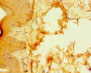 Immunohistochemistry of paraffin-embedded human skin tissue using CSB-PA020631ESR2HU at dilution of 1:100