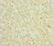 Immunohistochemistry of paraffin-embedded human liver tissue using CSB-PA020634HA01HU at dilution of 1:100