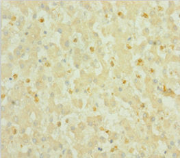 Immunohistochemistry of paraffin-embedded human liver tissue using CSB-PA020634HA01HU at dilution of 1:100