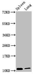 Western Blot Positive WB detected in: Mouse spleen tissue, Mouse lung tissue All lanes: S100a8 antibody at 3.8µg/ml Secondary Goat polyclonal to rabbit IgG at 1/50000 dilution Predicted band size: 11 kDa Observed band size: 11 kDa