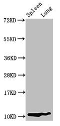 Western Blot Positive WB detected in: Rat spleen tissue, Rat lung tissue All lanes: S100a8 antibody at 3.2µg/ml Secondary Goat polyclonal to rabbit IgG at 1/50000 dilution Predicted band size: 11 kDa Observed band size: 11 kDa