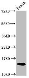 Western Blot Positive WB detected in: Mouse brain tissue All lanes: S100a9 antibody at 3.9µg/ml Secondary Goat polyclonal to rabbit IgG at 1/50000 dilution Predicted band size: 14 kDa Observed band size: 14 kDa