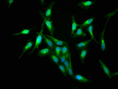 Immunofluorescence staining of Hela cells with CSB-PA020642LA01HU at 1:133, counter-stained with DAPI. The cells were fixed in 4% formaldehyde, permeabilized using 0.2% Triton X-100 and blocked in 10% normal Goat Serum. The cells were then incubat...