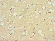 Immunohistochemistry of paraffin-embedded human brain tissue using CSB-PA020643ESR1HU at dilution of 1:100