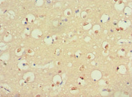 Immunohistochemistry of paraffin-embedded human brain tissue using CSB-PA020643ESR1HU at dilution of 1:100