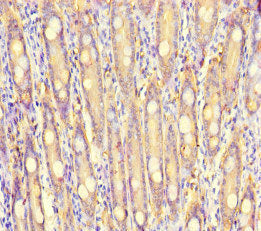 Immunohistochemistry of paraffin-embedded human small intestine tissue using CSB-PA020644LA01HU at dilution of 1:100