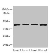 Western blot All lanes: S1PR1 antibody at 2µg/ml Lane 1: Jurkat whole cell lysate Lane 2: A375 whole cell lysate Lane 3: Mouse thymus tissue Lane 4: HepG2 whole cell lysate Secondary Goat polyclonal to rabbit IgG at 1/10000 dilution Predicted band...