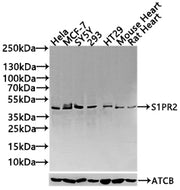 Western Blot Positive WB detected in: Hela whole cell lysate(30µg), MCF-7 whole cell lysate(30µg), SY5Y whole cell lysate(30µg), 293 whole cell lysate(30µg),HT29 whole cell lysate(30µg),Mouse Heart tissue lysate(30µg),Rat Heart tissue lysate(30µg)...