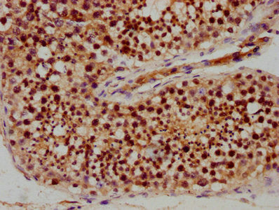 IHC image of CSB-PA020670LA01HU diluted at 1:400 and staining in paraffin-embedded human testis tissue performed on a Leica BondTM system. After dewaxing and hydration, antigen retrieval was mediated by high pressure in a citrate buffer (pH 6.0)....