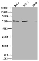 Western Blot Positive WB detected in: Hela whole cell lysate, MCF-7 whole cell lysate, A549 whole cell lysate All lanes: SAMHD1 antibody at 1:2000 Secondary Goat polyclonal to rabbit IgG at 1/50000 dilution Predicted band size: 73, 64, 69 kDa Obse...
