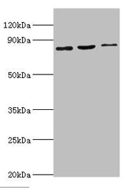 Western blot All lanes: SATB1 antibody at 2ug/ml Lane 1: Mouse brain tissue Lane 2: 293T whole cell lysate Lane 3: Jurkat whole cell lysate Secondary Goat polyclonal to rabbit IgG at 1/10000 dilution Predicted band size: 86, 90 kDa Observed band s...
