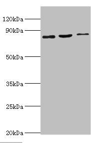Western blot All lanes: SATB1 antibody at 2ug/ml Lane 1: Mouse brain tissue Lane 2: 293T whole cell lysate Lane 3: Jurkat whole cell lysate Secondary Goat polyclonal to rabbit IgG at 1/10000 dilution Predicted band size: 86, 90 kDa Observed band s...