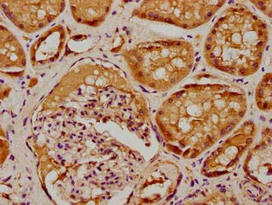 IHC image of CSB-PA020731LA01HU diluted at 1:100 and staining in paraffin-embedded human kidney tissue performed on a Leica BondTM system. After dewaxing and hydration, antigen retrieval was mediated by high pressure in a citrate buffer (pH 6.0)....