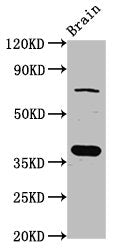 Western Blot Positive WB detected in: Rat brain tissue All lanes: SCAMP1 antibody at 4ug/ml Secondary Goat polyclonal to rabbit IgG at 1/50000 dilution Predicted band size: 38, 19 kDa Observed band size: 38 kDa