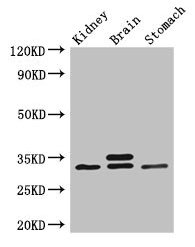 Western Blot Positive WB detected in: Mouse kidney tissue, Mouse brain tissue, Mouse stomach tissue All lanes: SCGN antibody at 3µg/ml Secondary Goat polyclonal to rabbit IgG at 1/50000 dilution Predicted band size: 33 kDa Observed band size: 33 kDa