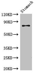 Western Blot Positive WB detected in: Mouse stomach tissue All lanes: SCIN antibody at 3.5µg/ml Secondary Goat polyclonal to rabbit IgG at 1/50000 dilution Predicted band size: 81, 66, 53 kDa Observed band size: 81 kDa