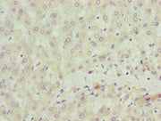 Immunohistochemistry of paraffin-embedded human liver tissue using CSB-PA020826LA01HU at dilution of 1:100