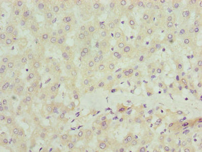 Immunohistochemistry of paraffin-embedded human liver tissue using CSB-PA020826LA01HU at dilution of 1:100