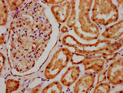 IHC image of CSB-PA020827LA01HU diluted at 1:700 and staining in paraffin-embedded human kidney tissue performed on a Leica BondTM system. After dewaxing and hydration, antigen retrieval was mediated by high pressure in a citrate buffer (pH 6.0)....